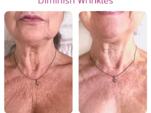 Spain NECKPON Hydrolized Collagen Neck Cream