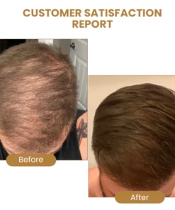 Suna Plant Extract Hair Growth Oil