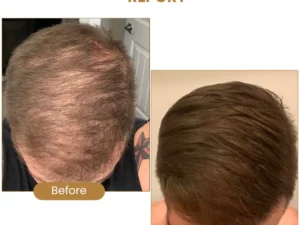 Suna Plant Extract Hair Growth Oil