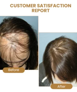 Suna Plant Extract Hair Growth Oil