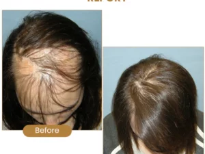 Suna Plant Extract Hair Growth Oil