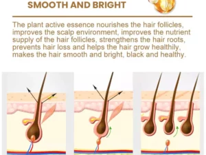 Suna Plant Extract Hair Growth Oil