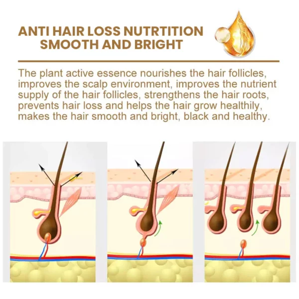Aceite para el crecimiento del cabello con extracto de planta Suna