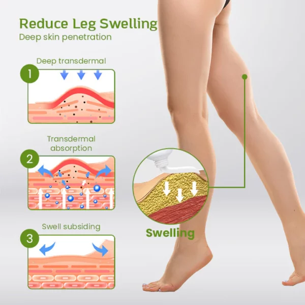 Ungüento antihinchazón para aliviar las piernas SwellEase™