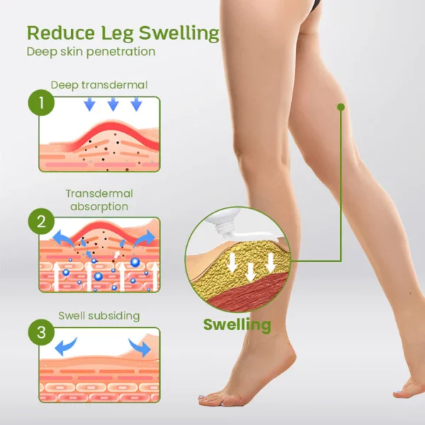 Pommade anti-gonflement pour les jambes SwellEase™