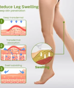 SwellEase™ Leg Relief Anti-Swelling Ointment