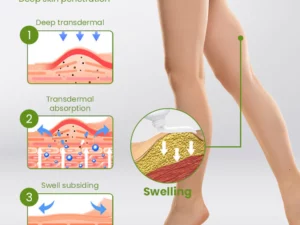 SwellEase™ Leg Relief Anti-Swelling Ointment