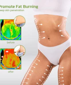 SwellEase™ Leg Relief Anti-Swelling Ointment