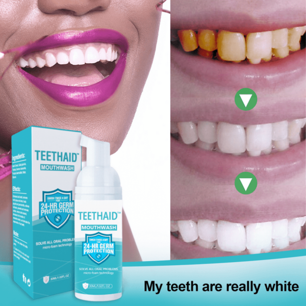 TEETHAID™ SUUNVESITE JA KIVENPOISTUS