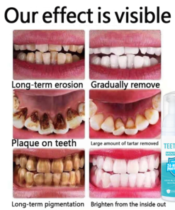 TEETHAID™ MOUTHWASH and CALCULUS REMOVAL