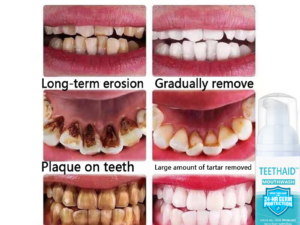 TEETHAID™ MOUTHWASH and CALCULUS REMOVAL