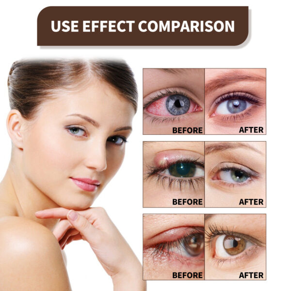Глазные капли Fivfivgo™ EYELIGHT Ultra Eye Therapy Lubricant Eye Drops