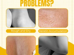 Thai Whitening Yellow Peeling Oil