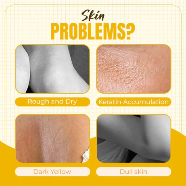 Óleo de peeling amarelo branqueador tailandês