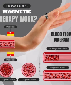 Therapeutic Magnetic Ring