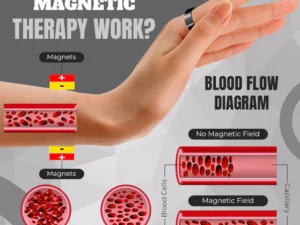 Therapeutic Magnetic Ring