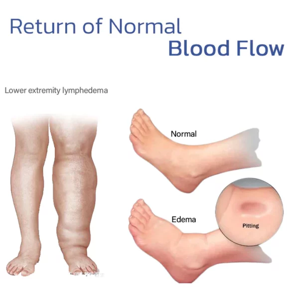 ThermaFlex™ संपीड़न घुटने का ब्रेस-निचले अंग की सूजन और गठिया से राहत देता है