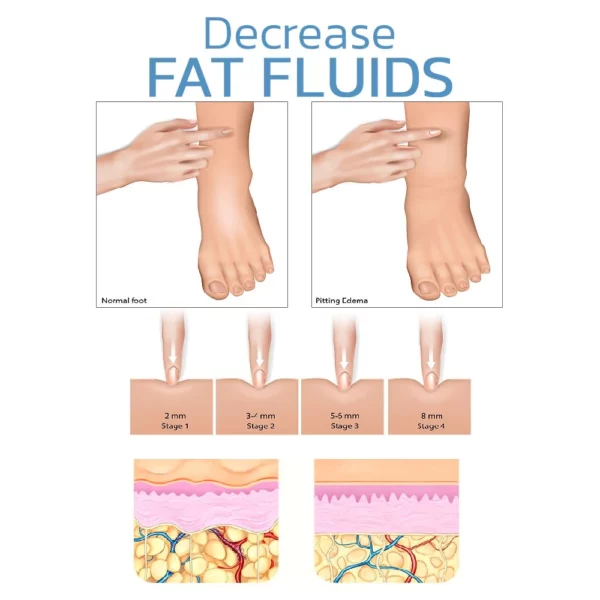 La rodillera de compresión ThermaFlex™ alivia el edema y la artritis de las extremidades inferiores