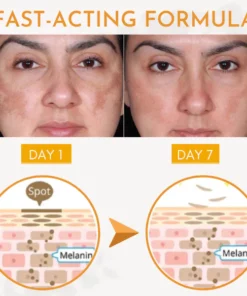 TripleAction BlemishSkin Corrector Serum