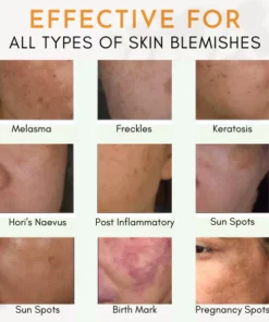 TripleAction BlemishSkin Corrector Serum