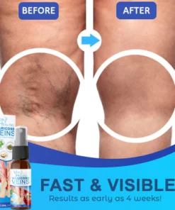 Veinhealing Varicose Veins Treatment Spray