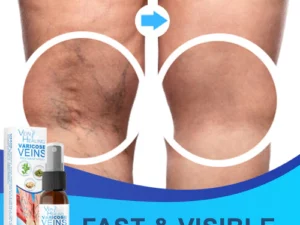 Veinhealing Varicose Veins Treatment Spray
