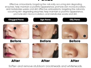 ZeroPore InstantPerfection Moisturizing Serum
