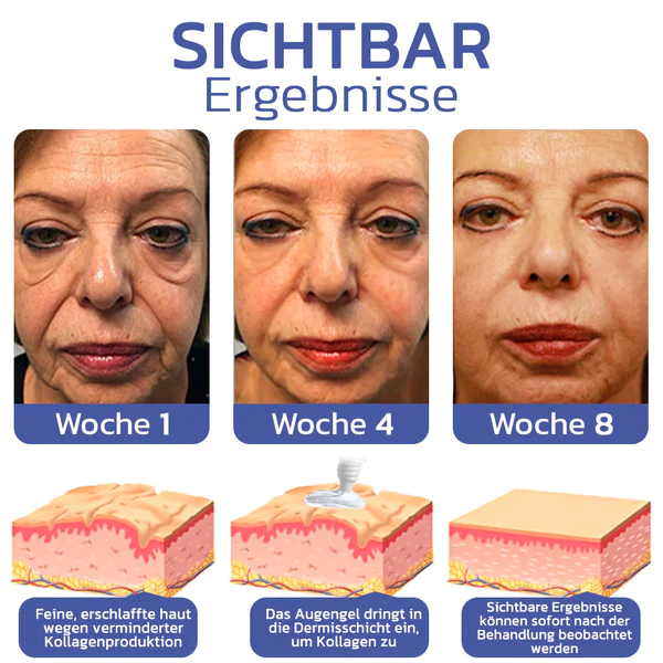 flysmus™ BIGEYES Straffende Creme zur تعریف der Augenlider