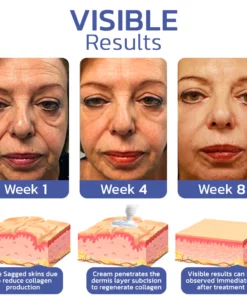 flysmus™ BIGEYES Lifting Eyelid Defining Cream