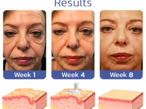 flysmus™ BIGEYES Lifting Eyelid Defining Cream