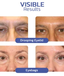 flysmus™ BIGEYES Lifting Eyelid Defining Cream