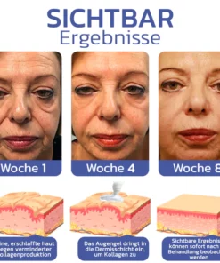 flysmus™ BIGEYES Straffende Creme zur Definition der Augenlider
