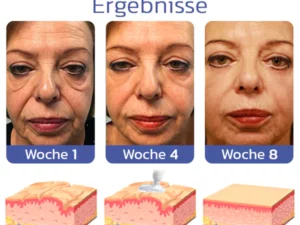 flysmus™ BIGEYES Straffende Creme zur Definition der Augenlider