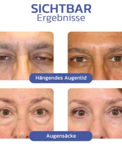 flysmus™ BIGEYES Straffende Creme zur Definition der Augenlider