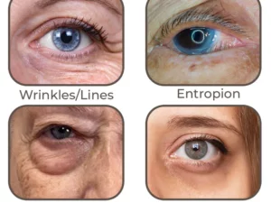 flysmus™ Electric Vibration Massage Eye Cream Tube