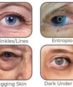 flysmus™ Elektrische Vibrationsmassage Augencreme Tube