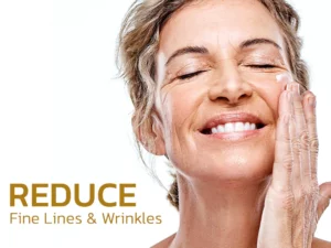 flysmus™ Microcurrent Facial Toning Device