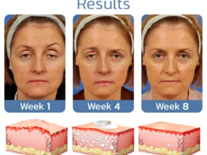flysmus™ OPENEYES Erwecken Peptid Straffende Augengel