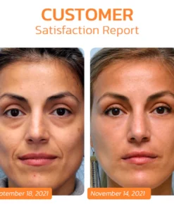 flysmus™ Pureskin Korean Soluble Collagen Film