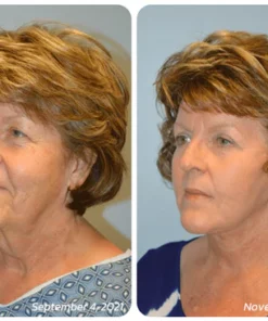 flysmus™ Pureskin Korean Soluble Collagen Film