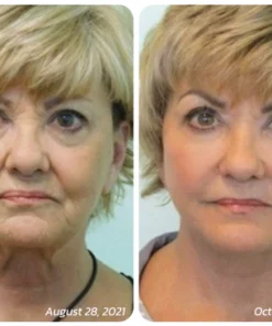 flysmus™ Pureskin Korean Soluble Collagen Film