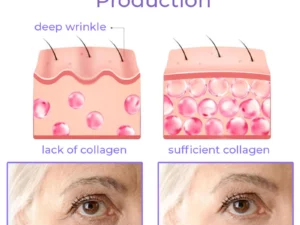 flysmus™ Soluble Collagen Thread & Nano Platinum Essence Facial Firming Set