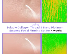 flysmus™ Soluble Collagen Thread & Nano Platinum Essence Facial Firming Set