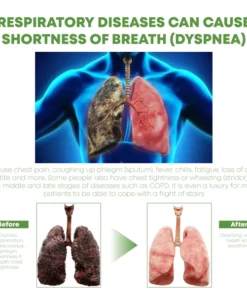 Alternative view of ATTDX ClearBreath HerbalTreatment Drops