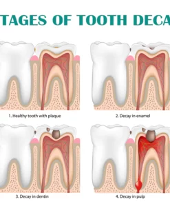 ATTDX StainOff WhiteningPRO Cleaning Mousse