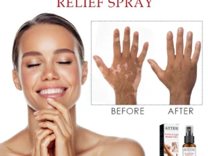 ATTDX VitiligoRemoval Relief Spray