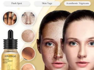 Blemish Treatment Serum