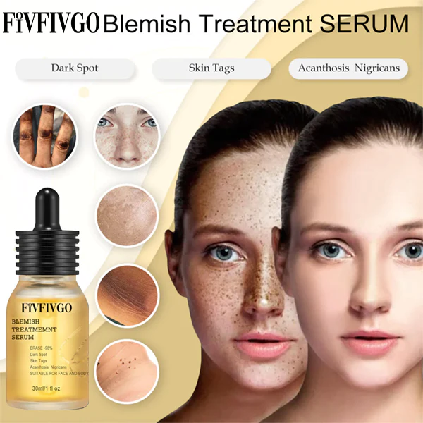 Serum de tratamento de manchas