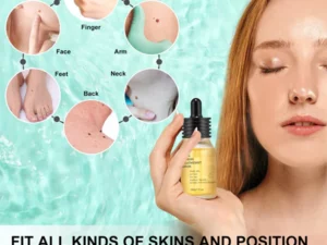 Blemish Treatment Serum