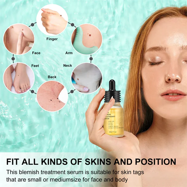 Serum de tratamento de manchas